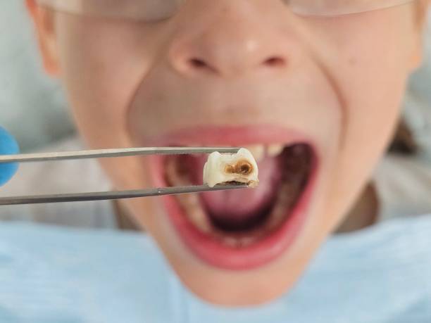 Best Emergency Treatment for Jaw Pain or Injury in Henderson, LA